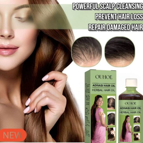 Adivasi Hair Oil OUHOE Herbal hair care for scalp cleansing hair loss prevention, and damage repair