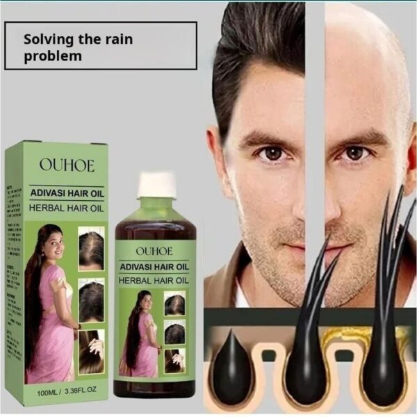 Adivasi Hair Oil OUHOE Herbal hair care for scalp cleansing hair loss prevention, and damage repair thumbnail 4