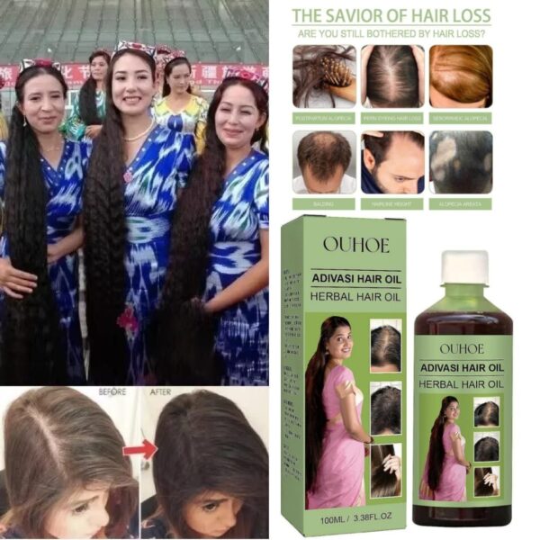 Adivasi Hair Oil OUHOE Herbal hair care for scalp cleansing hair loss prevention, and damage repair thumbnail 5