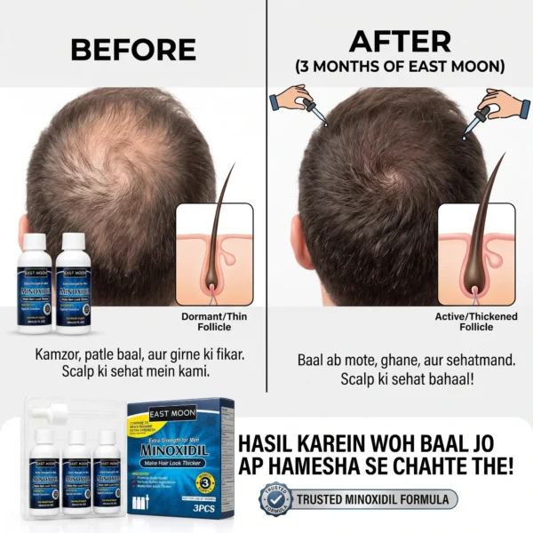 Kirkland Minoxidil 5% Hair Regrowth Treatment for Men