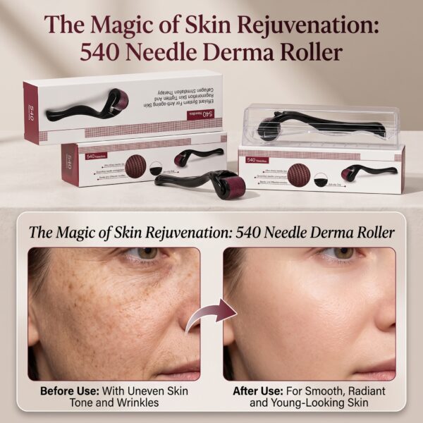 540 Needles Derma Roller for Skin & Hair Growth
