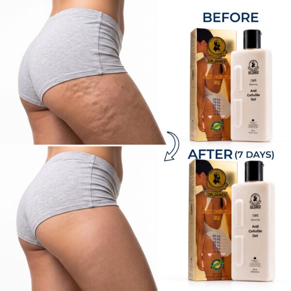 Dr. James 7 Days Slimming Anti Cellulite Ge